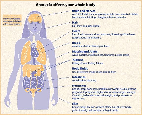 when can anorexia go