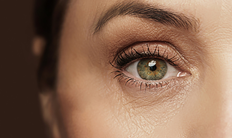 Female eye with wrinkled skin
